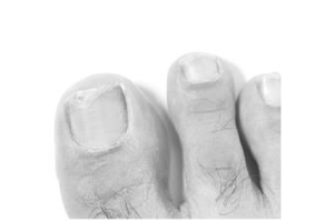 TERBINAFIN-1A Pharma Nagell.g.Nagelpilz 78,22mg/ml, 6.6 ml