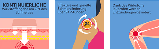 NUROFEN 24-timers smerteplaster 200 mg, 4 stk