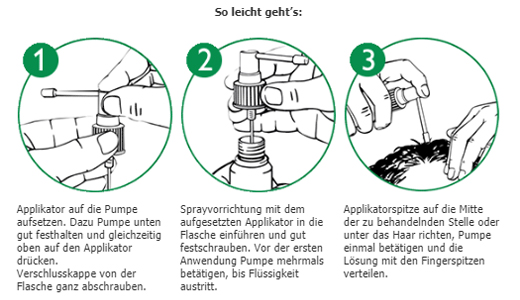 ALOPEXY 5% opløsning til påføring på huden, 3X60 ml
