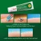 Ilon Protect salve (200 ml)