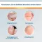 EndWarts® CLASSIC opløsning, 3 ml