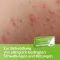 Cetirizin axicur® 10 mg filmovertrukne tabletter, 50 stk