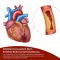 BEH Artery+ kapsler, 30 stk